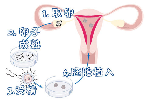 岩墨医疗
